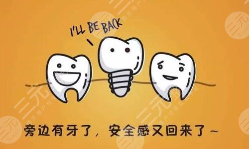 美国种植体和德国的哪个好？种植牙品牌大全+种植牙注意事项建议收藏！