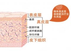 嗨体除皱与注射除皱的区别是什么?科普讲解&费用参考,注射美容不迷路! 嗨体除皱与注射除皱的区别是什么?科普讲解&费用参考,注射美容不迷路!