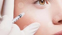 B****除皱的僵硬持续多久？价格&原理科普，别拿医美当儿戏！