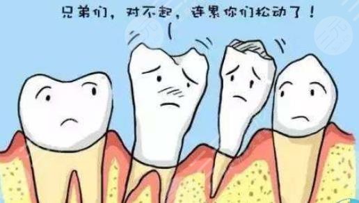 种植牙应该选择哪一种材质?