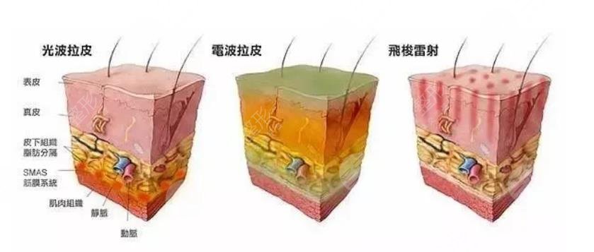热拉提