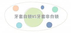 牙套自锁非自锁的区别|哪个好?价格参考表+适合人群+术后护理 牙套自锁非自锁的区别|哪个好?价格参考表+适合人群+术后护理
