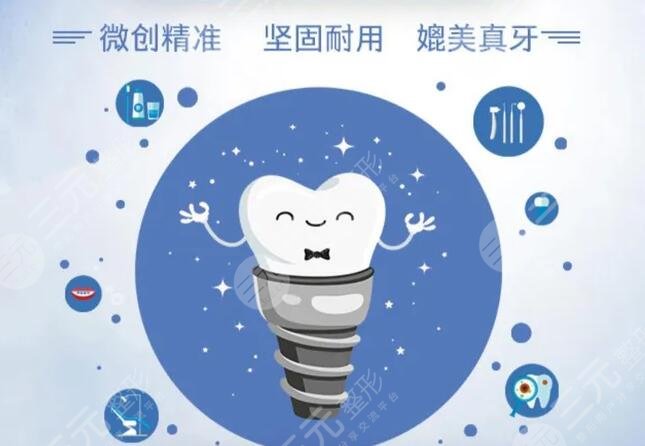 全口种植牙的寿命一般是多久?10年?20年?还是一辈子?专家怎么说?