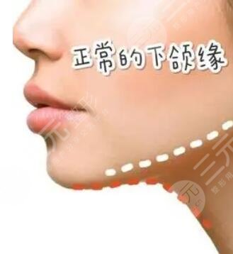 什么因素会影响下颌线的美感