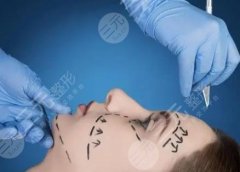 水波拉皮是怎么做的？能维持多久？水波拉皮除皱价格是多少？