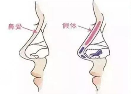 北京鼻王是谁