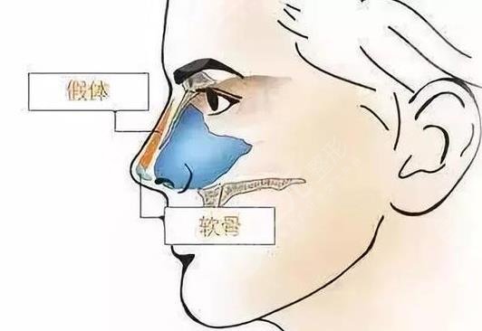 北京鼻王是谁
