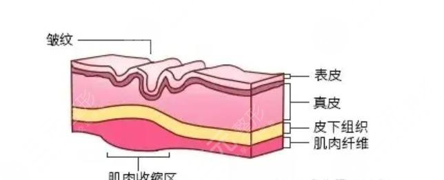 维持时间与术后护理事项有关