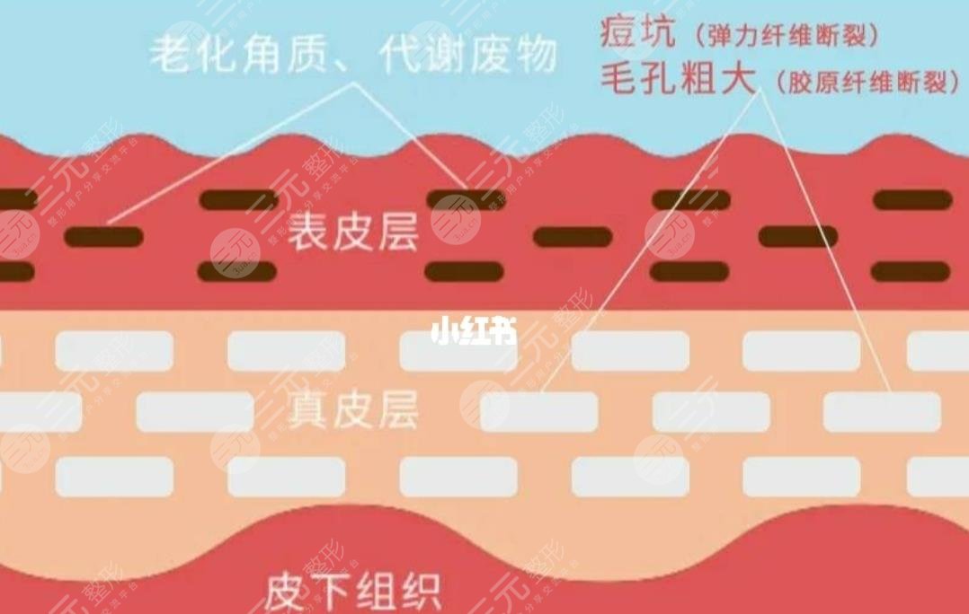中胚层抗衰