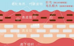中胚层抗衰和细胞重组比哪个贵?想要选性价比高的看这篇 中胚层抗衰和细胞重组比哪个贵?想要选性价比高的看这篇