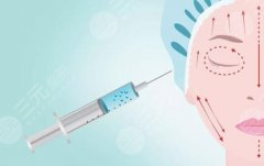 B****除皱的副作用有哪些？副作用盘点？看完后你还敢做吗?