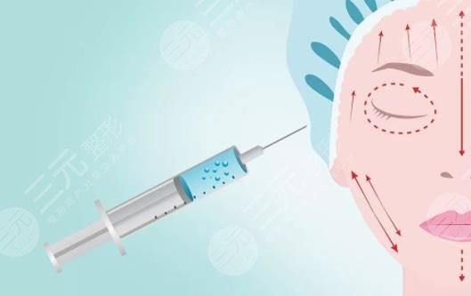 B****除皱的副作用有哪些