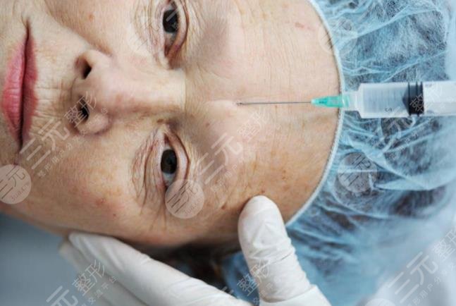 注射除皱注意事项