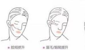 面部抗衰