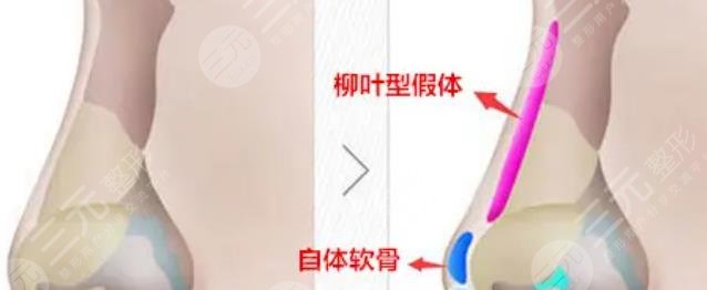 提升抗皱鼻子