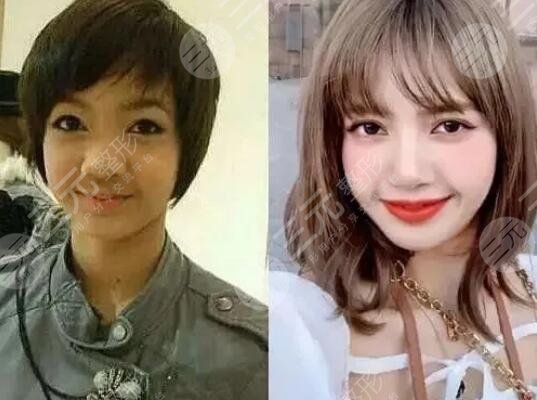 Lisa出道前后对比照