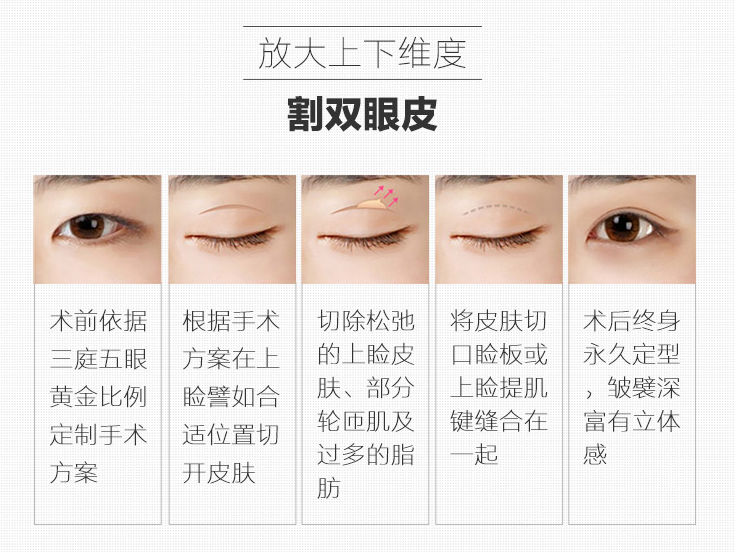 割双眼皮后1-7天恢复图文科普来咯！注意事项教你，助力靓丽大眼！