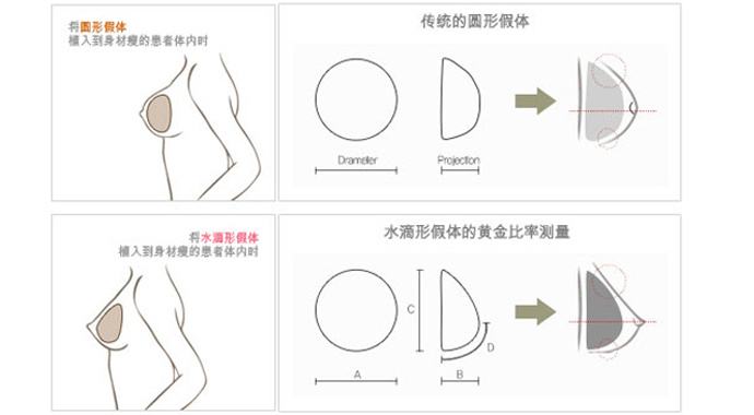 隆胸水滴好和圆形对比果图，哪个好看？假体丰胸术前必看干货！