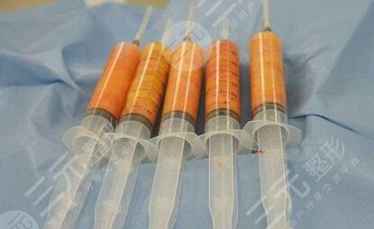 脂肪填充手术是否降低风险