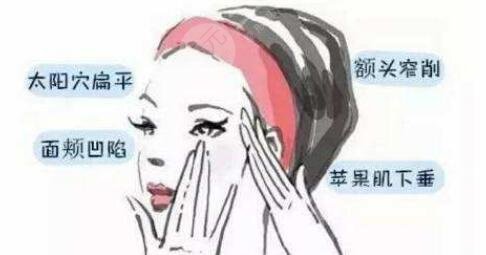 脂肪填充除皱果好不好