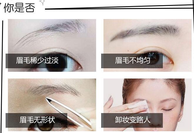 雾眉掉痂8天过程图片科普！纹眉的超全攻略来咯，美眉必看！