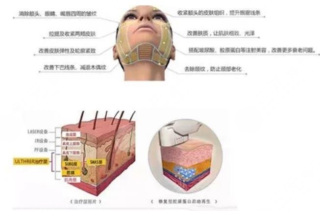 热玛吉
