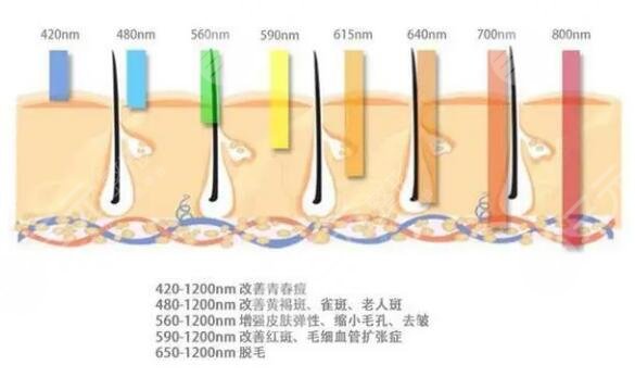 激光除皱抗衰手术到底是什么呢