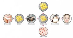 面部填充有什么后遗症,危害大吗?费用&注意事项全科普,要美不要坑! 面部填充有什么后遗症,危害大吗?费用&注意事项全科普,要美不要坑!