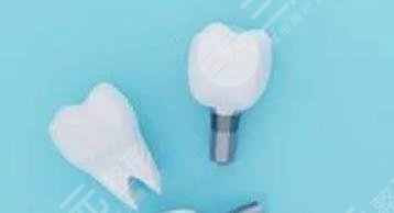 种植牙
