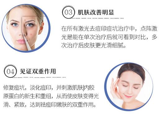 点阵激光痘坑修复图片