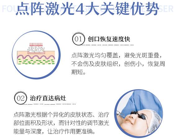 点阵激光痘坑修复图片