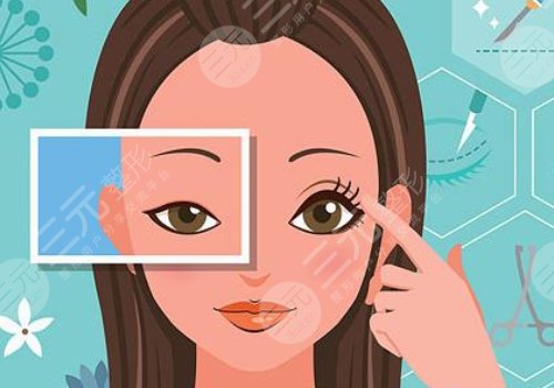 10个开内眼角9个留疤怎么办？怎么避免开眼角留疤？注意事项带你了解！