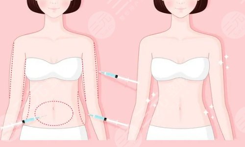 整容手术危险排名磨骨削骨吸脂减肥隆胸整形手术