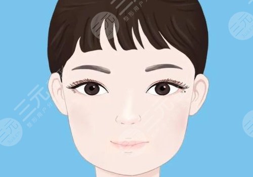 双眼皮弧度不佳