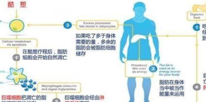 酷塑冷冻减脂