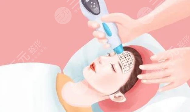 热玛吉