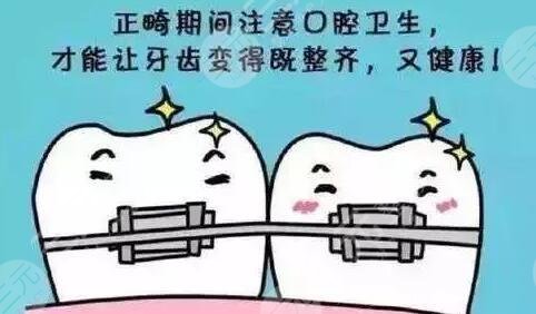 正畸矫正