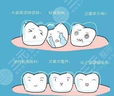 天津市口腔医院牙齿矫正经历分享
