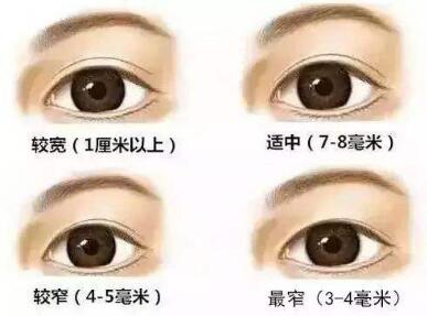 双眼皮6、7、8毫米果图对比！什么样的style适合你，速速来了解吧！