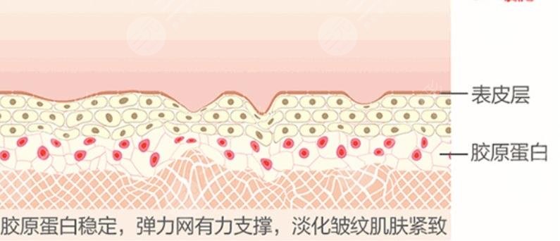 热玛吉