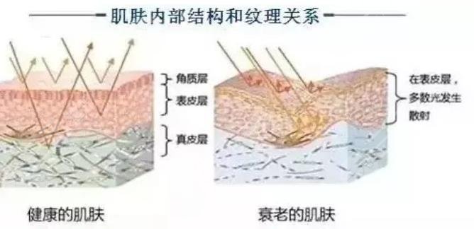 热玛吉
