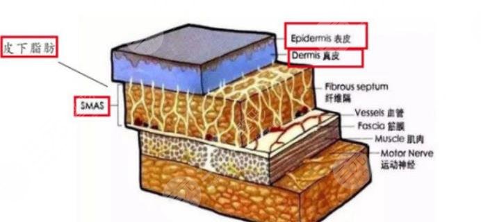热玛吉