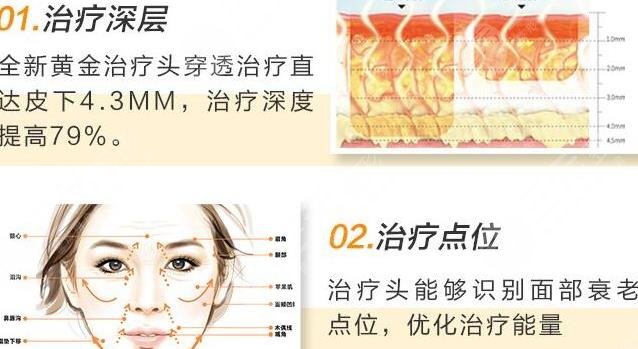 热玛吉