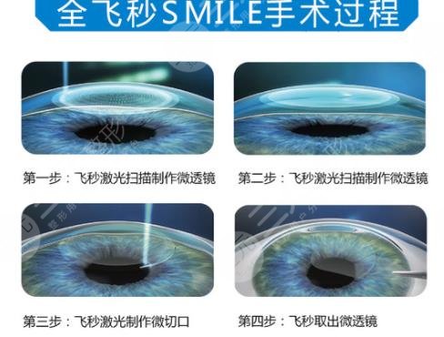 全飞秒