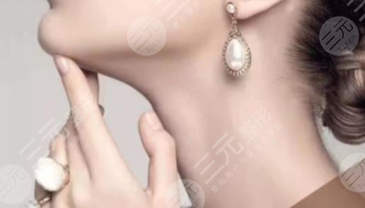 嗨体去颈纹