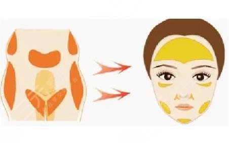 天津公安医院整形科面部脂肪填充