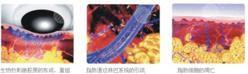 深蓝射频