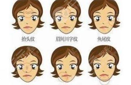热玛吉