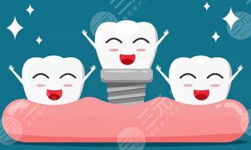 种植牙齿手术有什么优点呢