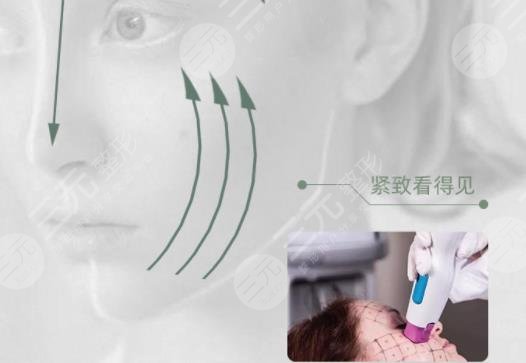 热玛吉